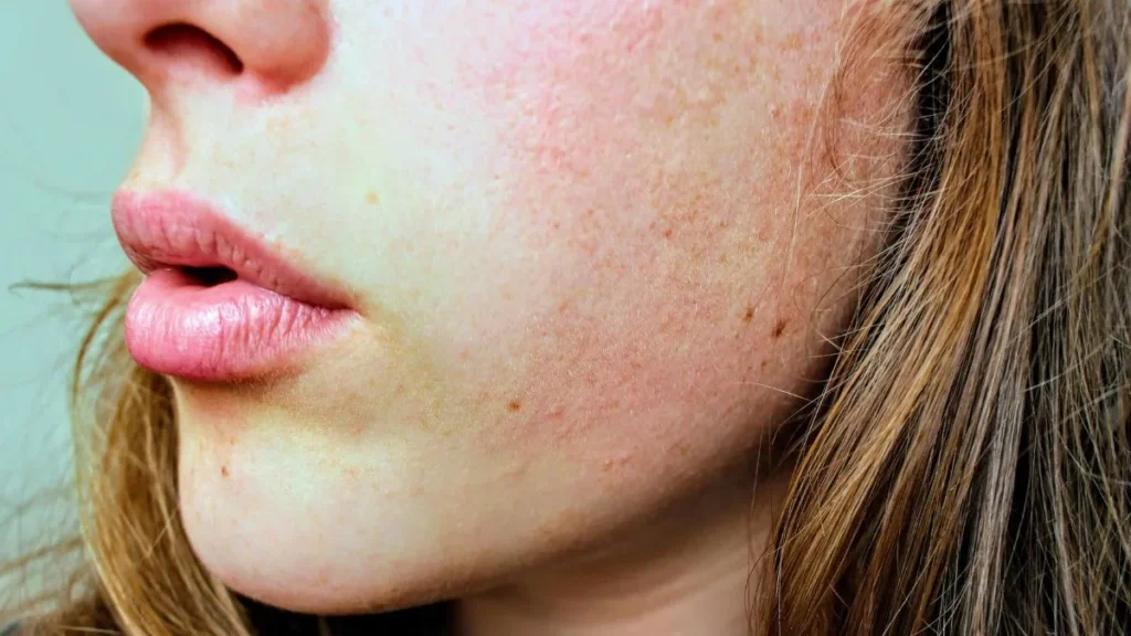 Skincare dry skin